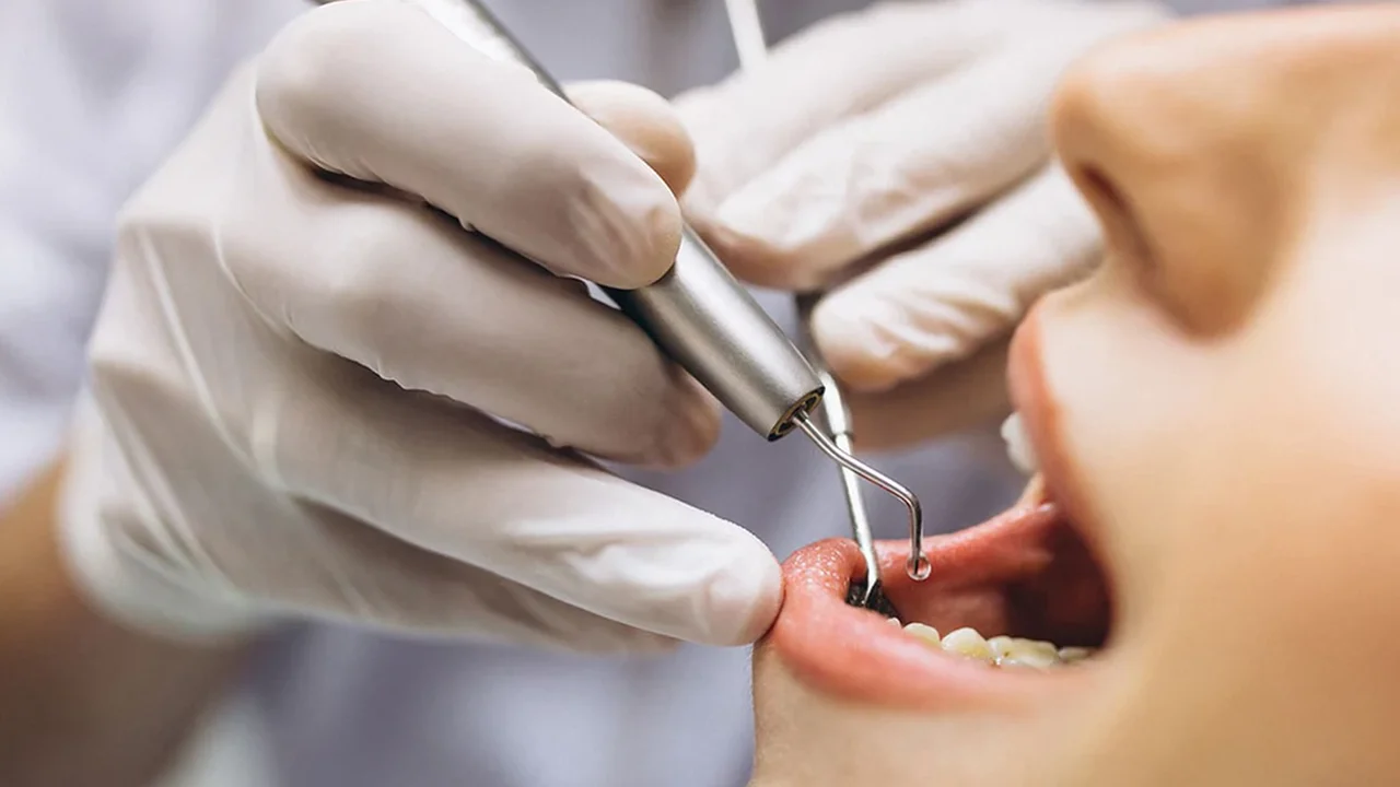Piezoelektrik ultrasonik uç ve su spreyi ile diş eti sınırında uygulanan periodontal biyofilm temizliği